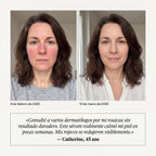Okidia Sérum Anti Rojeces: Calma total para tu piel