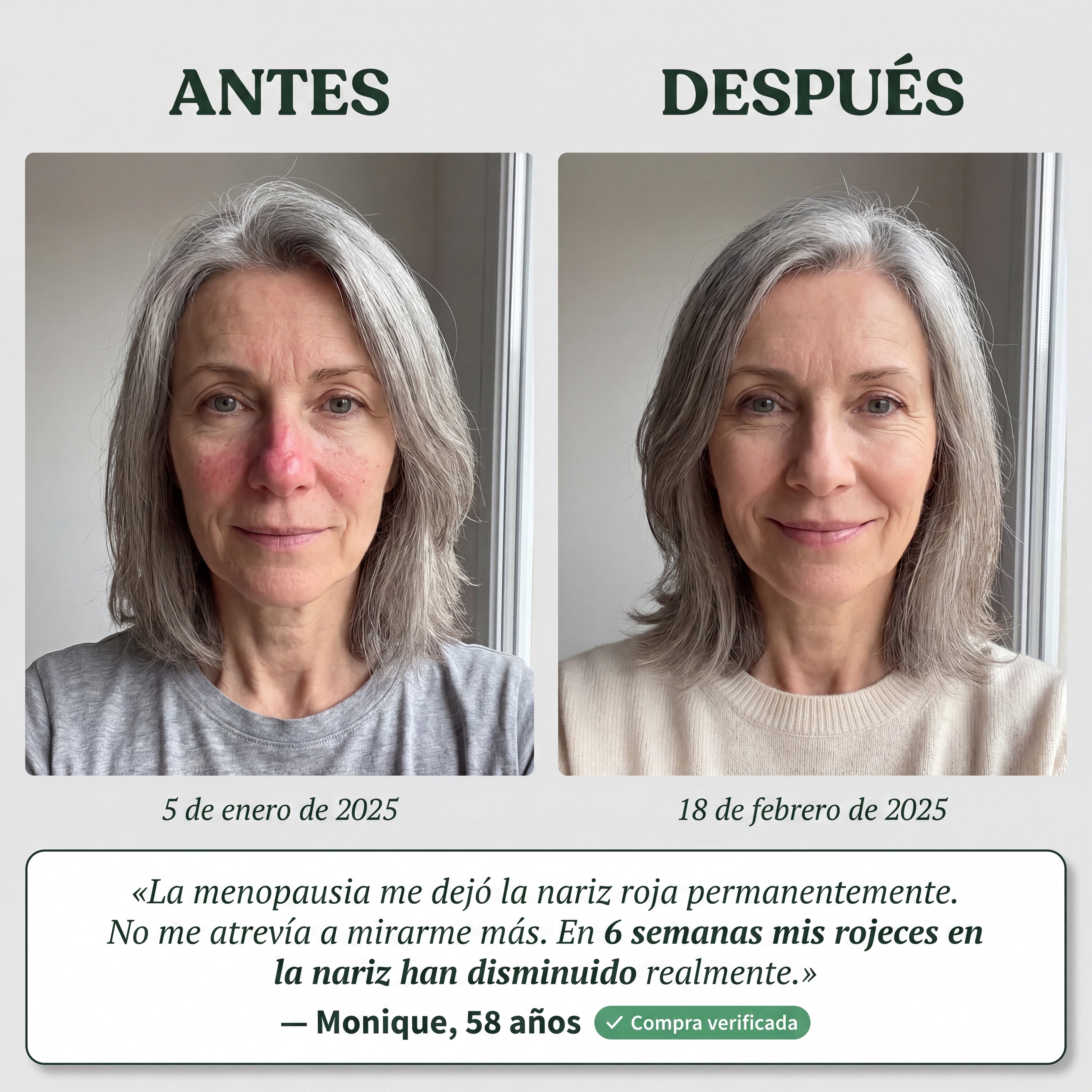 Okidia Sérum Anti Rojeces: Calma total para tu piel