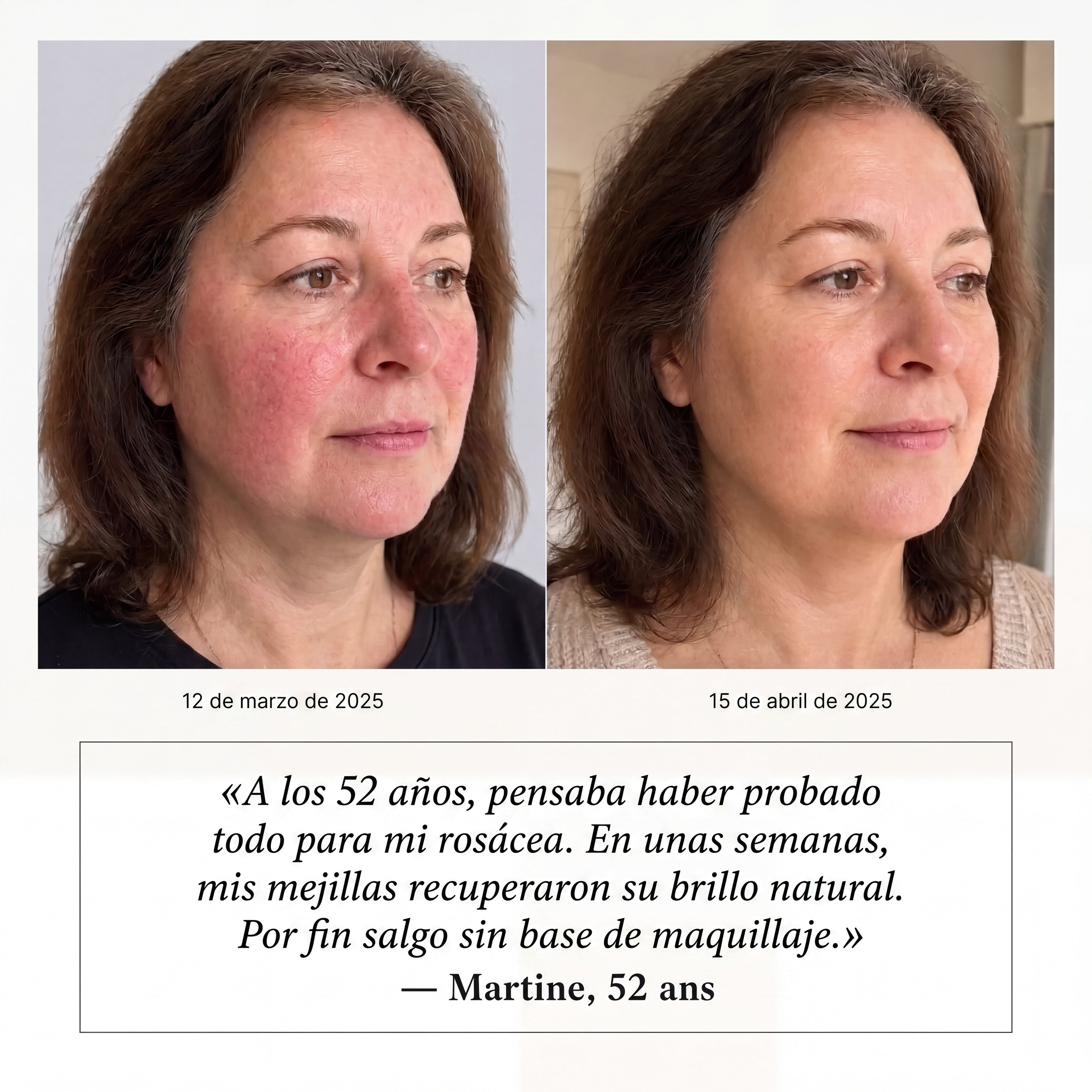 Okidia Sérum Anti Rojeces: Calma total para tu piel