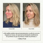 Okidia Sérum Anti Rojeces: Calma total para tu piel